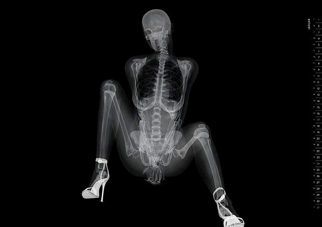 Рентгеновский pin-up